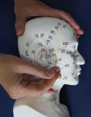 Akupunktur Homöosinatrie